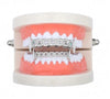 Cuban Round Moissanite Diamond Grillz