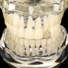 Custom Diamond Grillz