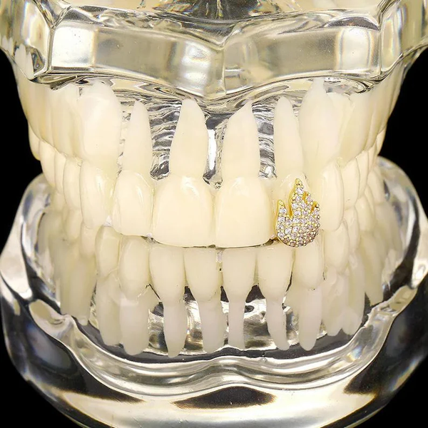 Custom Diamond Grillz